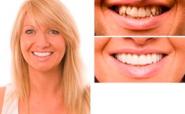 Improving your teeth and your smile – The Beauty Biz