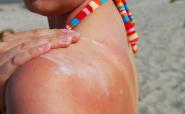 Protect your skin against melanoma – The Beauty Biz